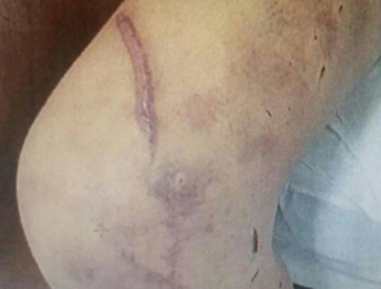 Após um mês em cárcere privado, jovem de 19 anos consegue fugir em Florianópolis